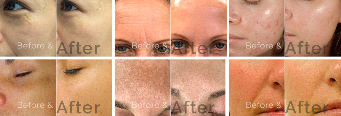 Facial Before and After. Safe Procedures with Proven Results.